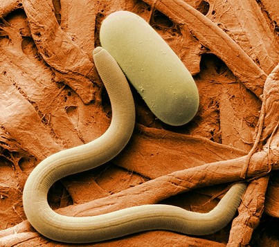 A soybean cyst nematode.jpg